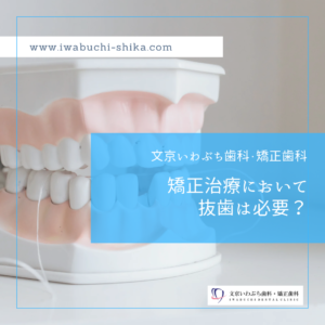 矯正治療において抜歯は必要？