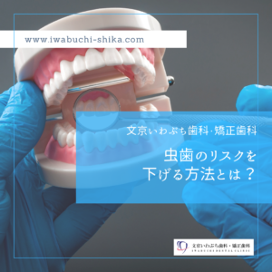 虫歯のリスクを下げる方法とは？