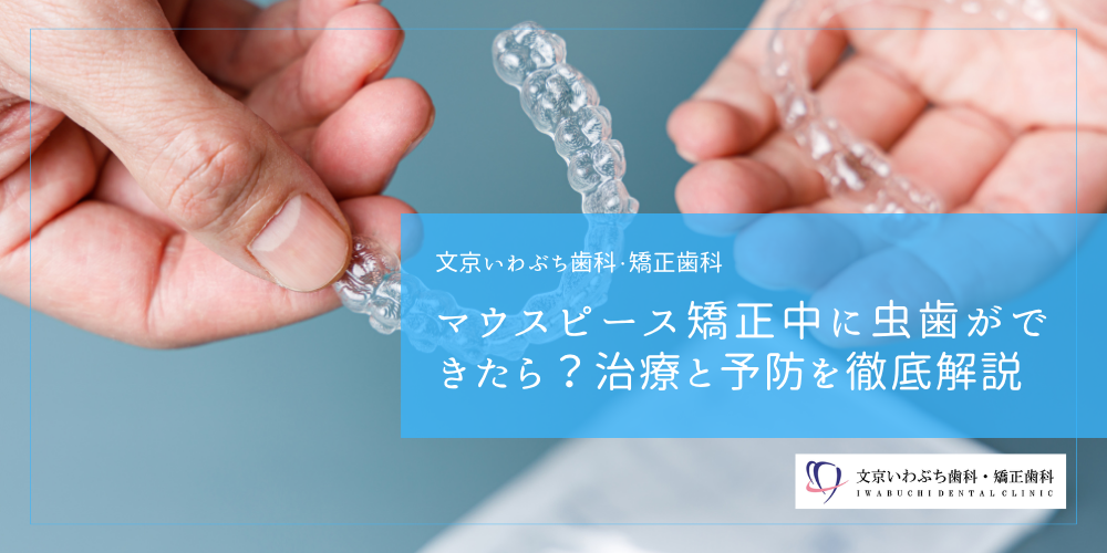 マウスピース矯正中に虫歯ができたら？治療と予防を徹底解説