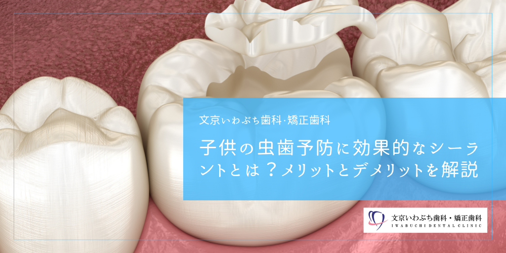 子供の虫歯予防に効果的なシーラントとは？メリットとデメリットを解説