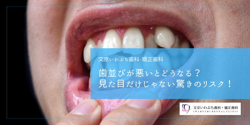 歯並びが悪いとどうなる？見た目だけじゃない驚きのリスク！