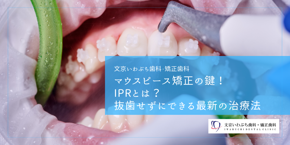 マウスピース矯正の鍵！IPRとは？抜歯せずにできる最新の治療法