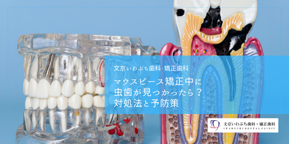 マウスピース矯正中に虫歯が見つかったら？対処法と予防策