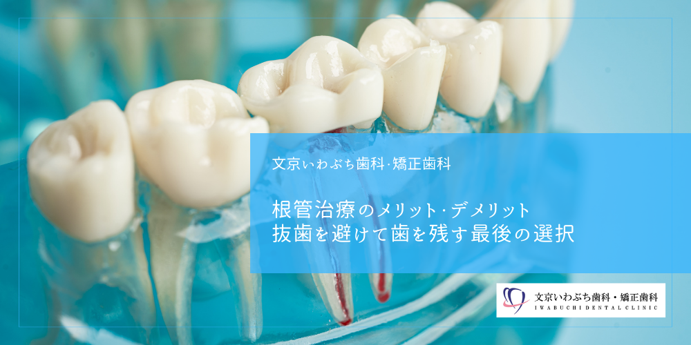 根管治療のメリット・デメリット|抜歯を避けて歯を残す最後の選択
