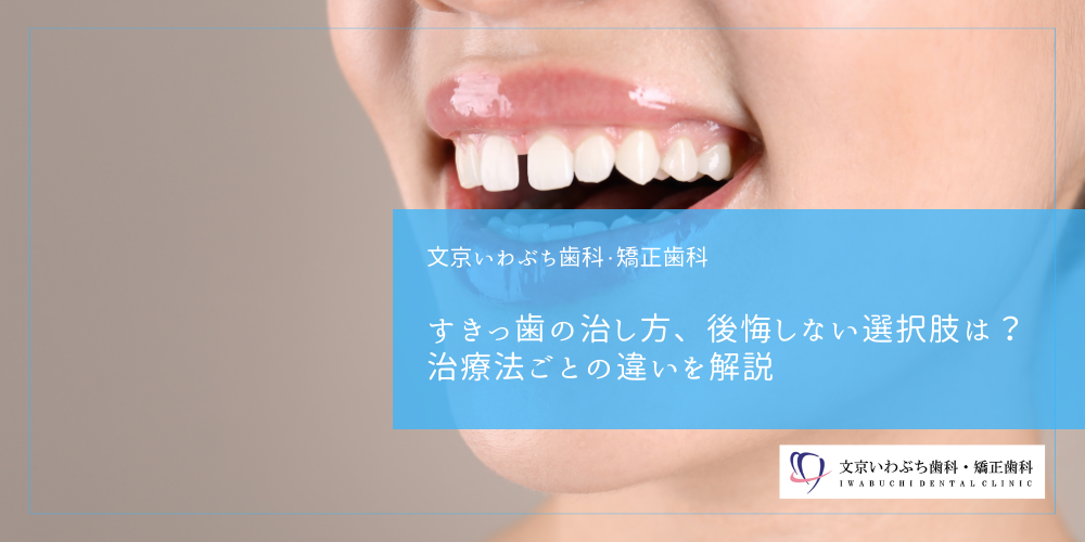すきっ歯の治し方、後悔しない選択肢は？治療法ごとの違いを解説