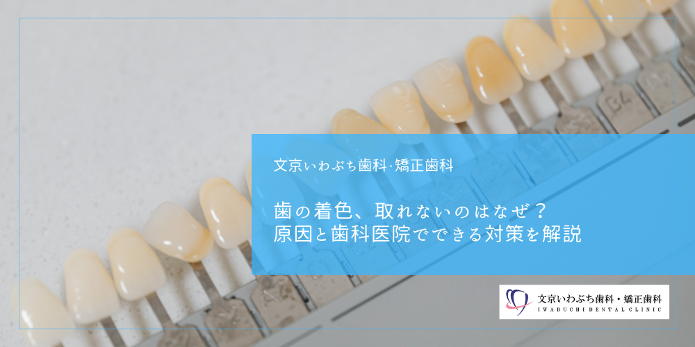 歯の着色、取れないのはなぜ？原因と歯科医院でできる対策を解説