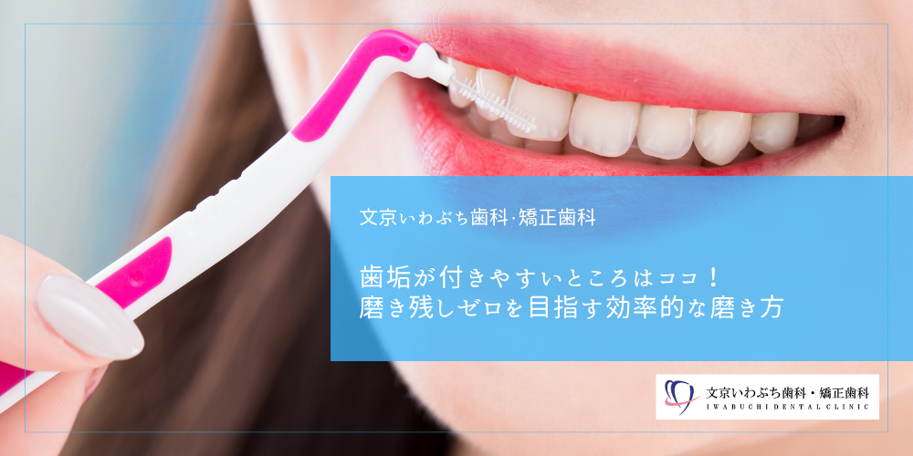 歯垢が付きやすいところはココ!磨き残しゼロを目指す効率的な磨き方