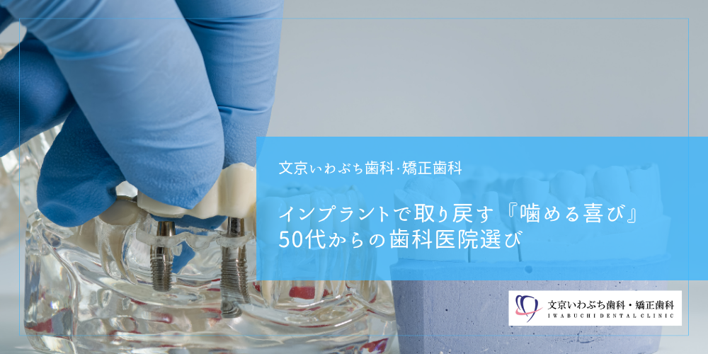 インプラントで取り戻す『噛める喜び』50代からの歯科医院選び