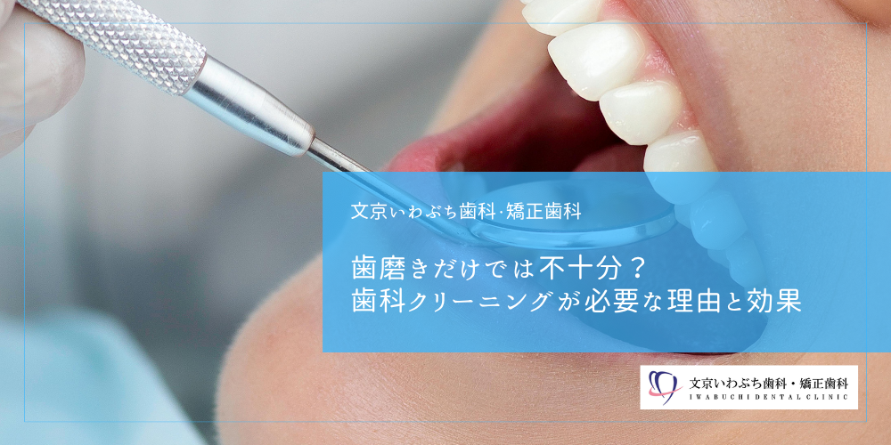 歯磨きだけでは不十分？歯科クリーニングが必要な理由と効果
