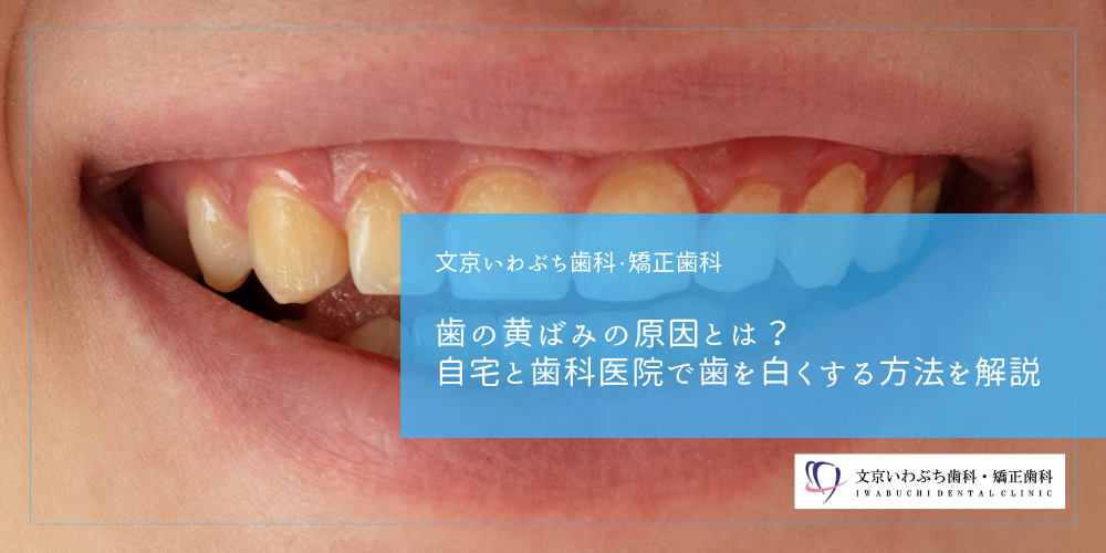 歯の黄ばみの原因とは？自宅と歯科医院で歯を白くする方法を解説