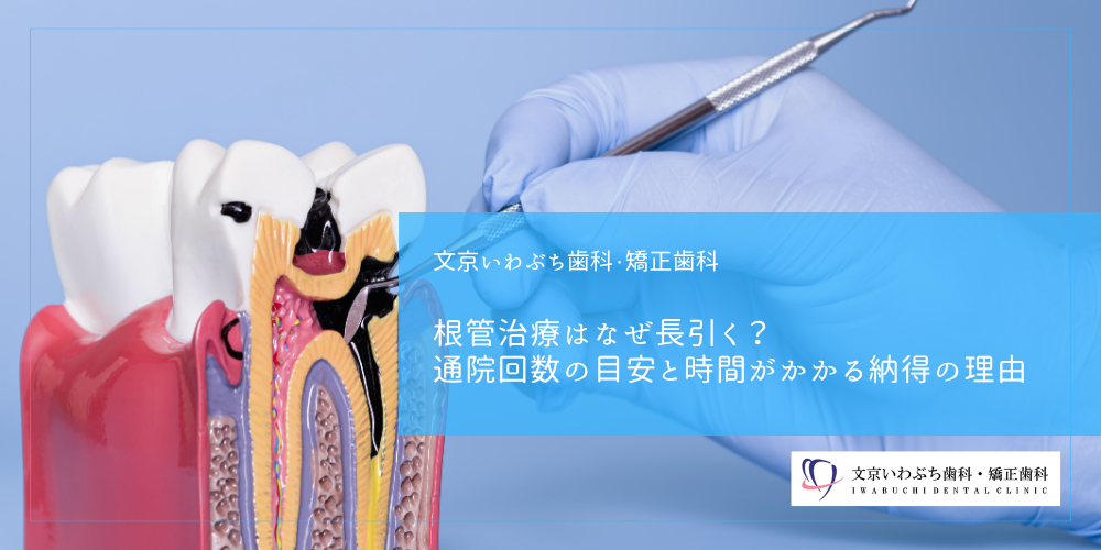 根管治療はなぜ長引く？通院回数の目安と時間がかかる納得の理由